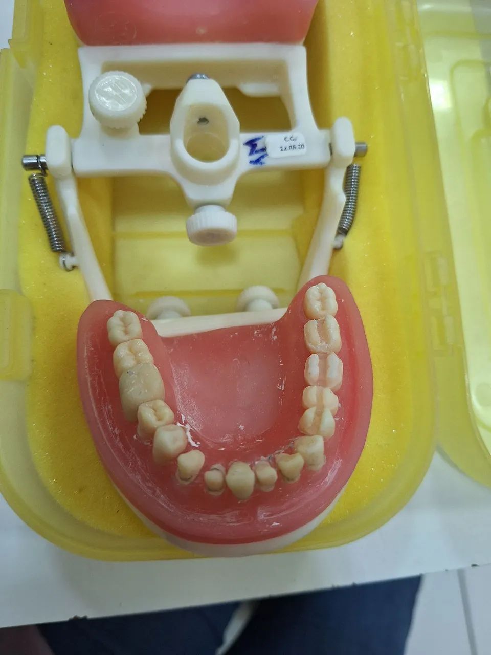 Modelo Dentística - Pronew ODONTOLOGIA  - Foto 4