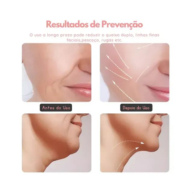 Massageador Facial Led Aparelho Tratamento Com Luz (Cor Sortida) - Foto 3