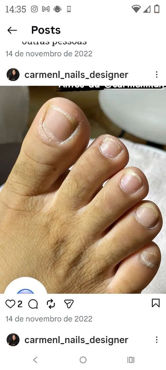 Nails  - Foto 4