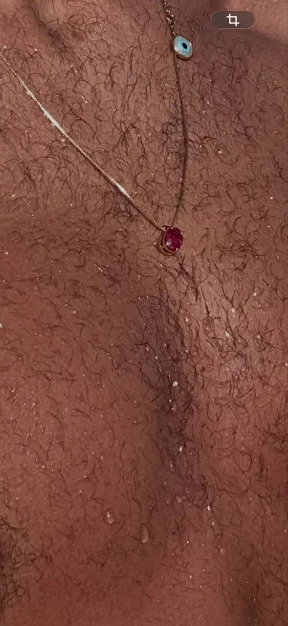 Pedra de RUBI  - Foto 2