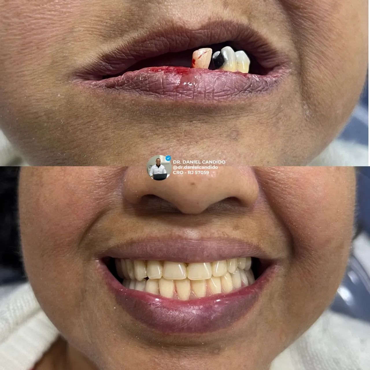 Serviços odontológicos  no engenho novo  - Foto 3