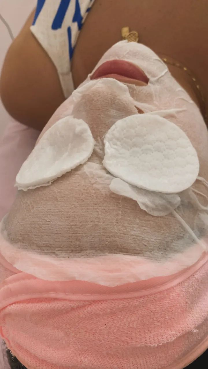 Limpeza de pele profunda e tratamento de Acne 
