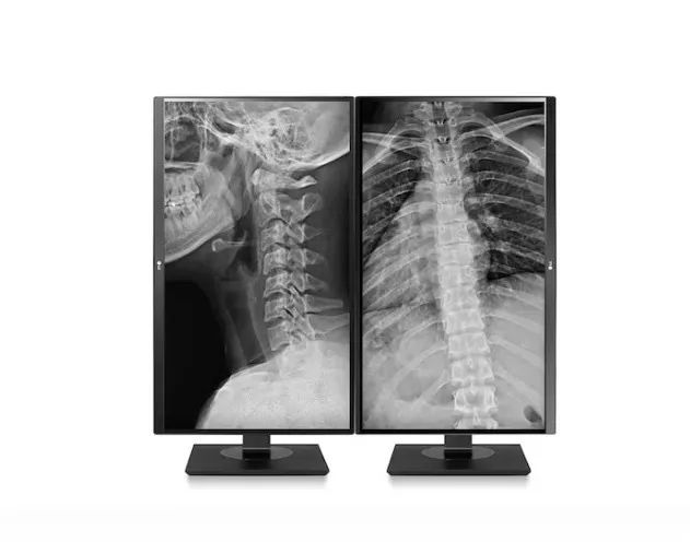 Monitor LG de diagnóstico para Raio X e Computação  - Foto 2