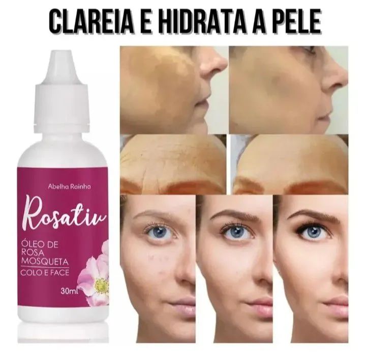 Óleo rosa mosqueta abelha rainha - Foto 2