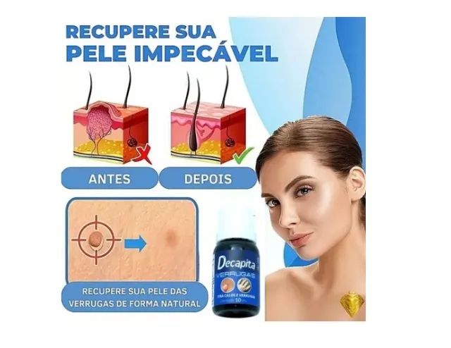 Decapita Removedor de Verrugas Pointss - Foto 2