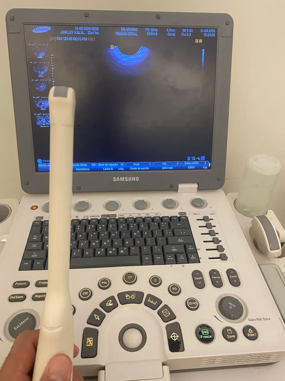 Aparelho de Ultrassom Samsung U6 - Foto 4