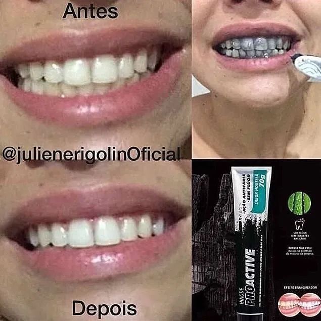 Pro Active tratamento pro seus dentes - Foto 2