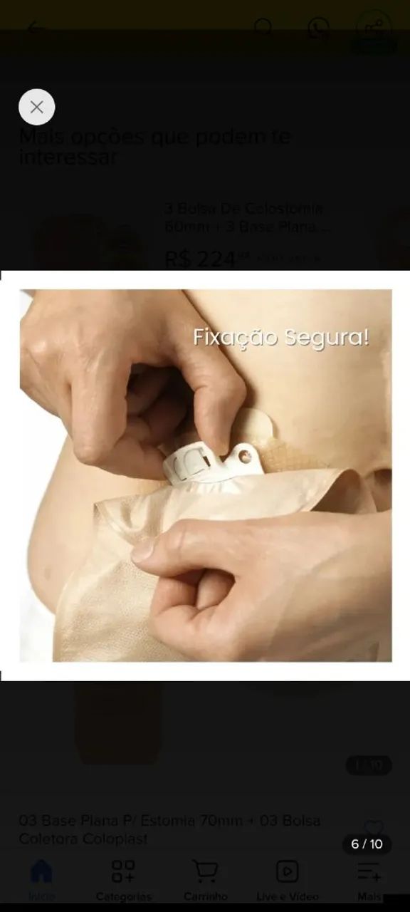 Bolsa de colostomia  - Foto 4