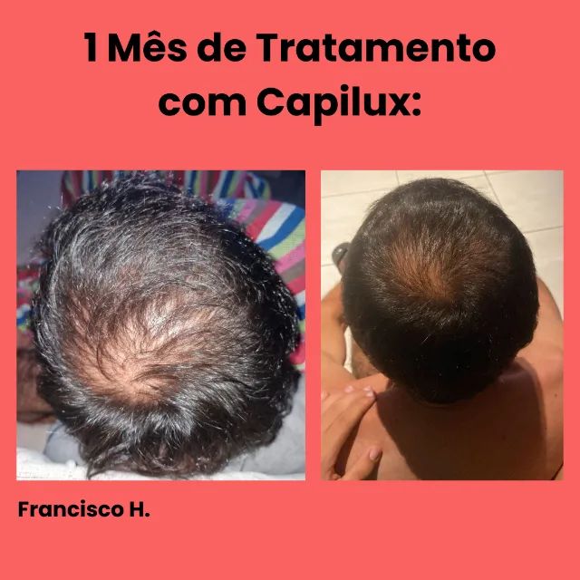 PROMOÇÃO CAPILUX -  Sérum Fortalecedor para Cabelos, Barba, Bigode e Sobrancelhas - Foto 3