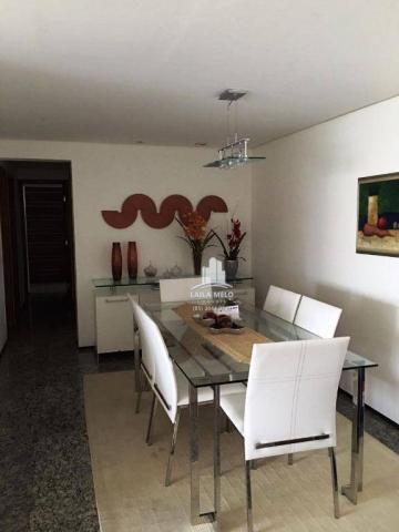 Apartamento residencial à venda com 03 suítes, aldeota, fortaleza. - Foto 3