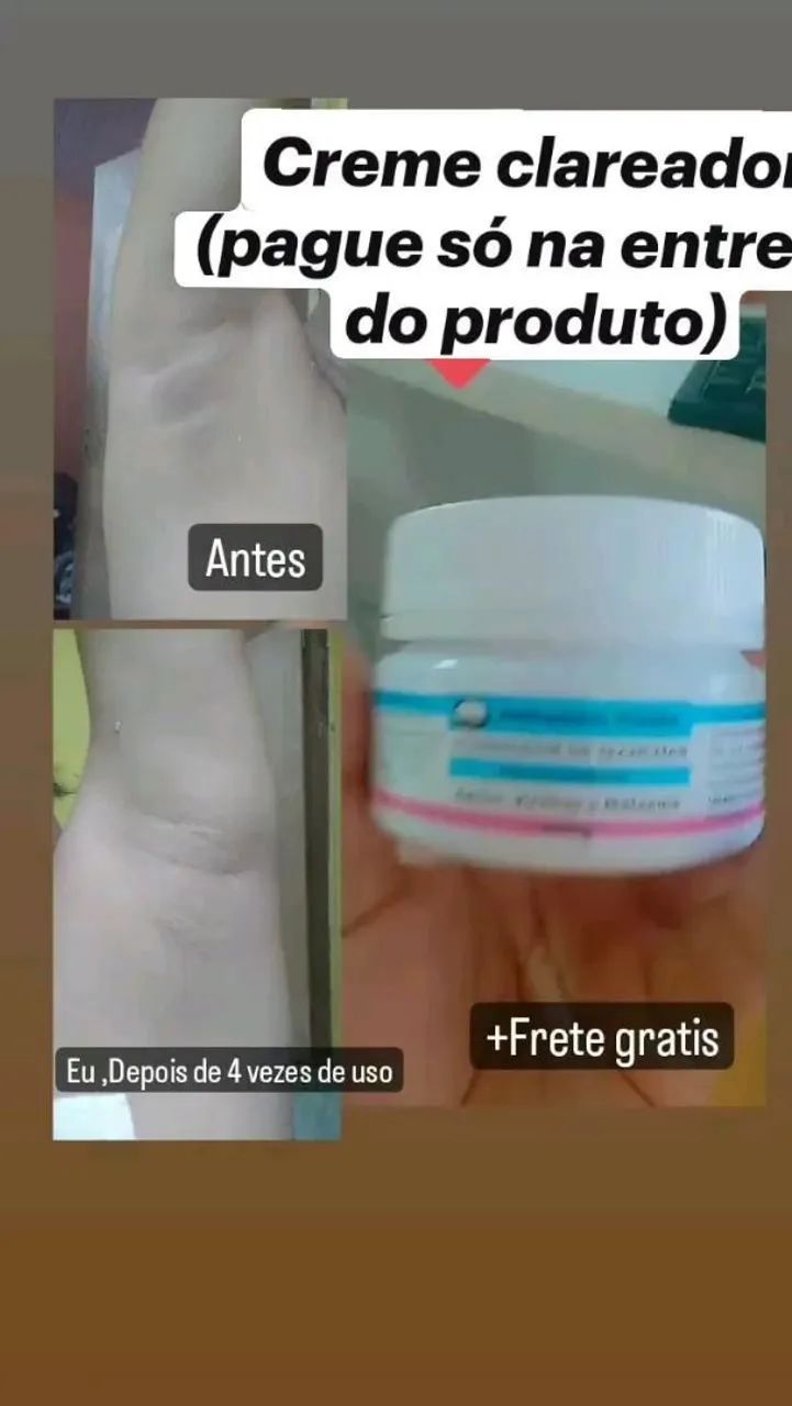 Clareador de manchas ? só pague na entrega  - Foto 2