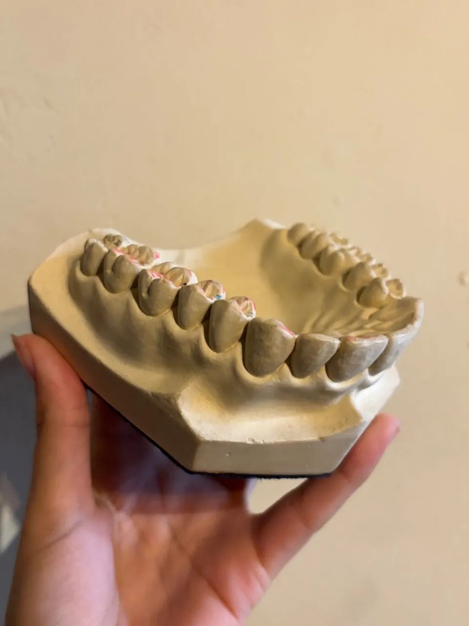 Modelo Odontológico de Oclusão - Foto 3