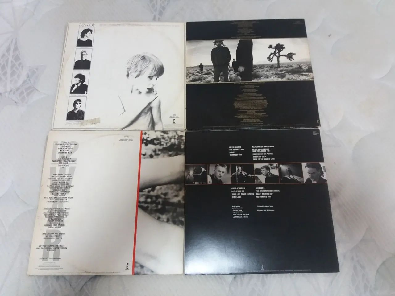 Pacote U2 - Foto 2