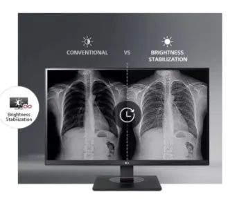 Monitor LG de diagnóstico para Raio X e Computação  - Foto 4