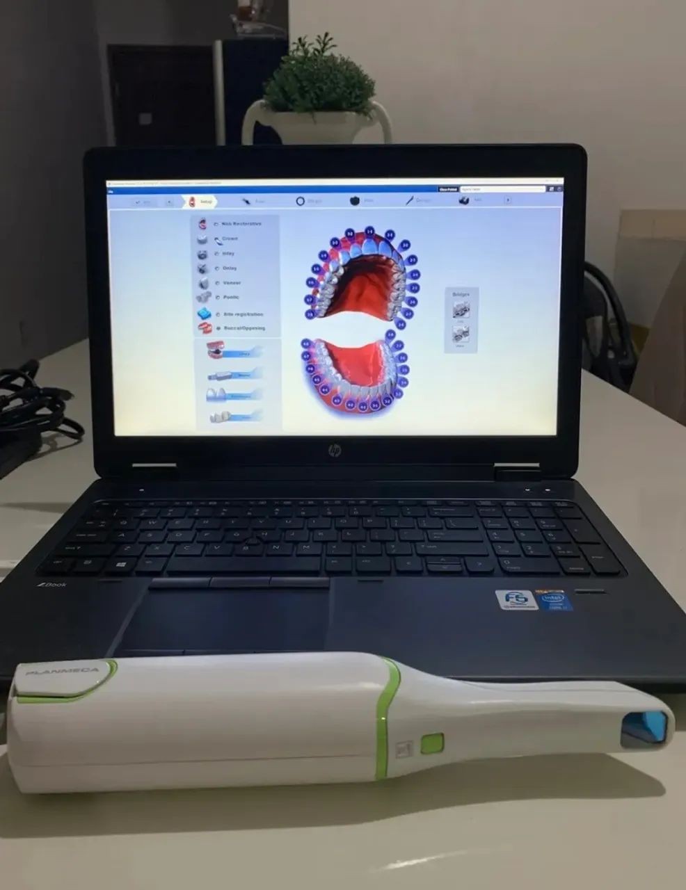 Scanner Intraoral Planmeca Planscan D4d + Notebook Hp Zbook - Foto 5