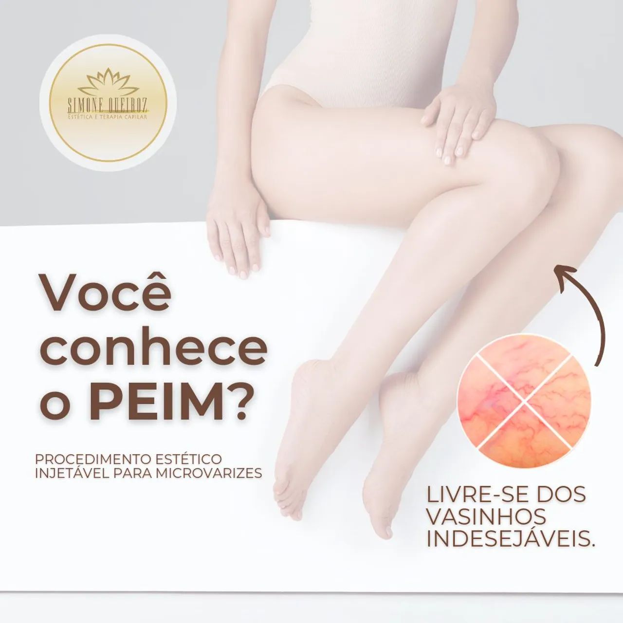 Tratamento para microvarizes 