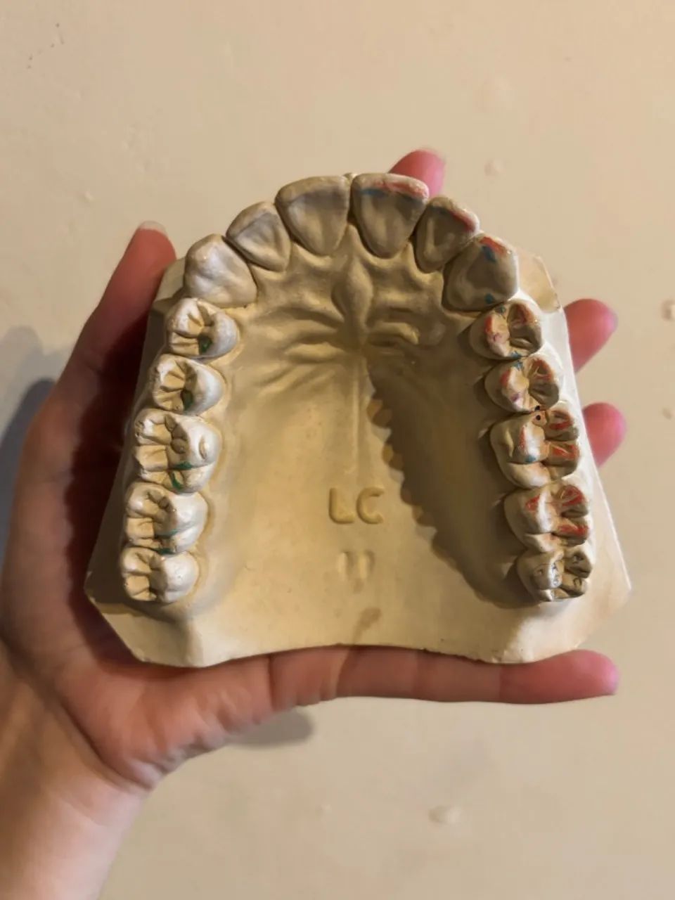 Modelo Odontológico de Oclusão - Foto 4