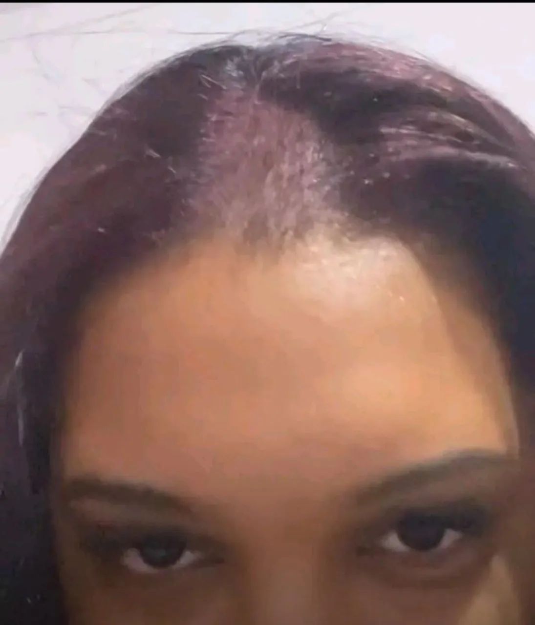 Topo de cabelo humano - Foto 3