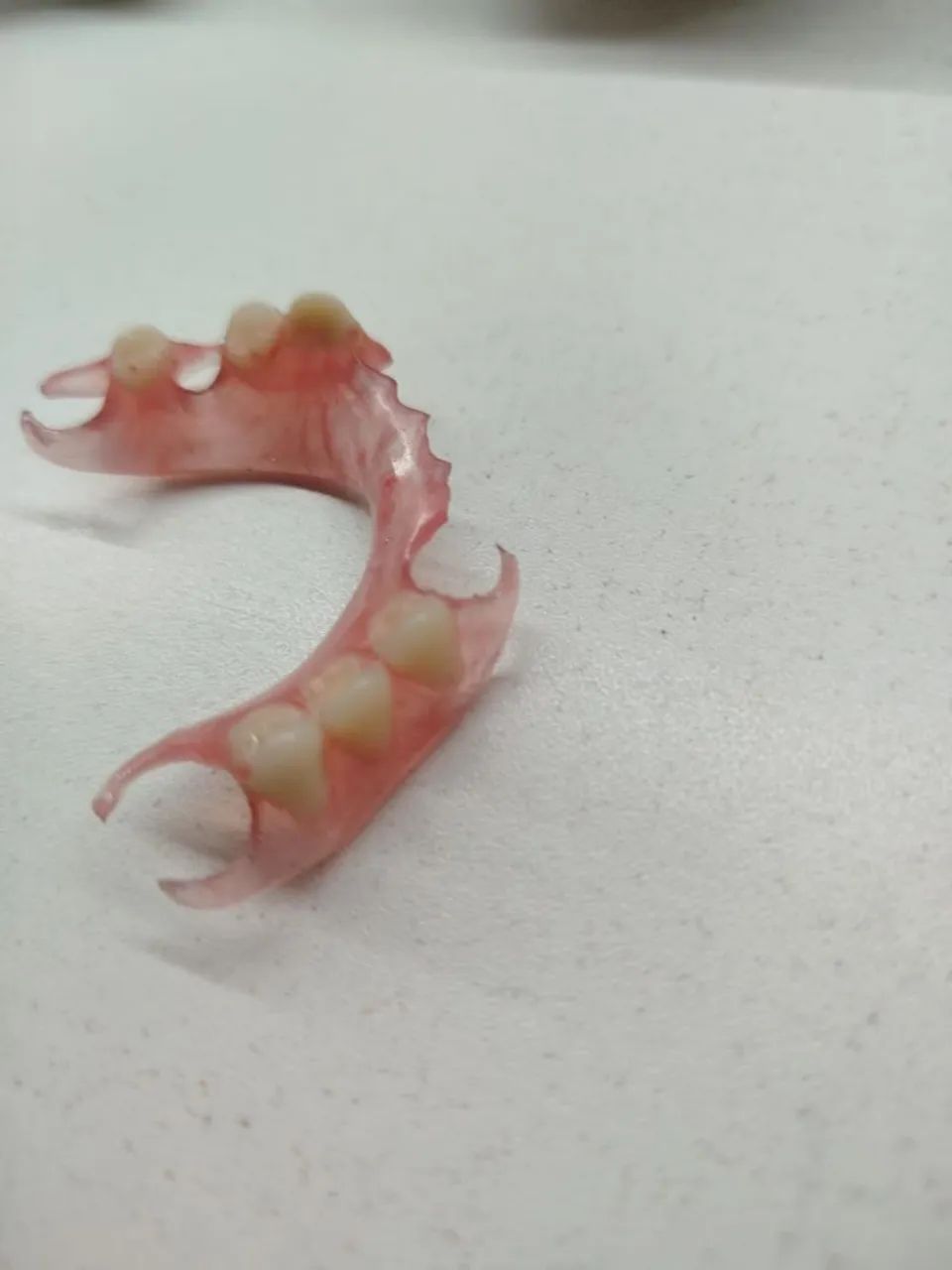 Prótese dentária  - Foto 4