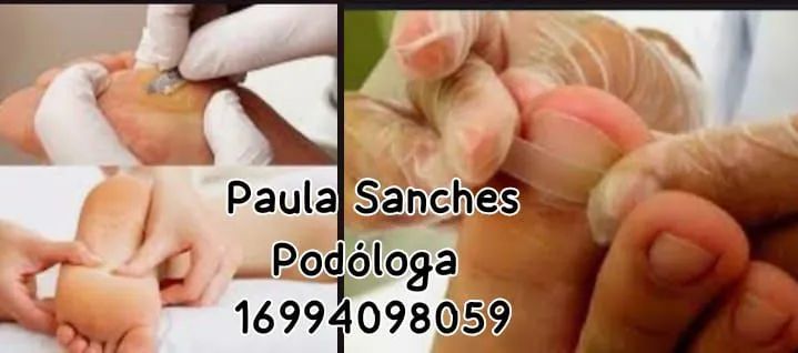 Paula Sanches Podóloga cuidando da saúde dos seus pés ?