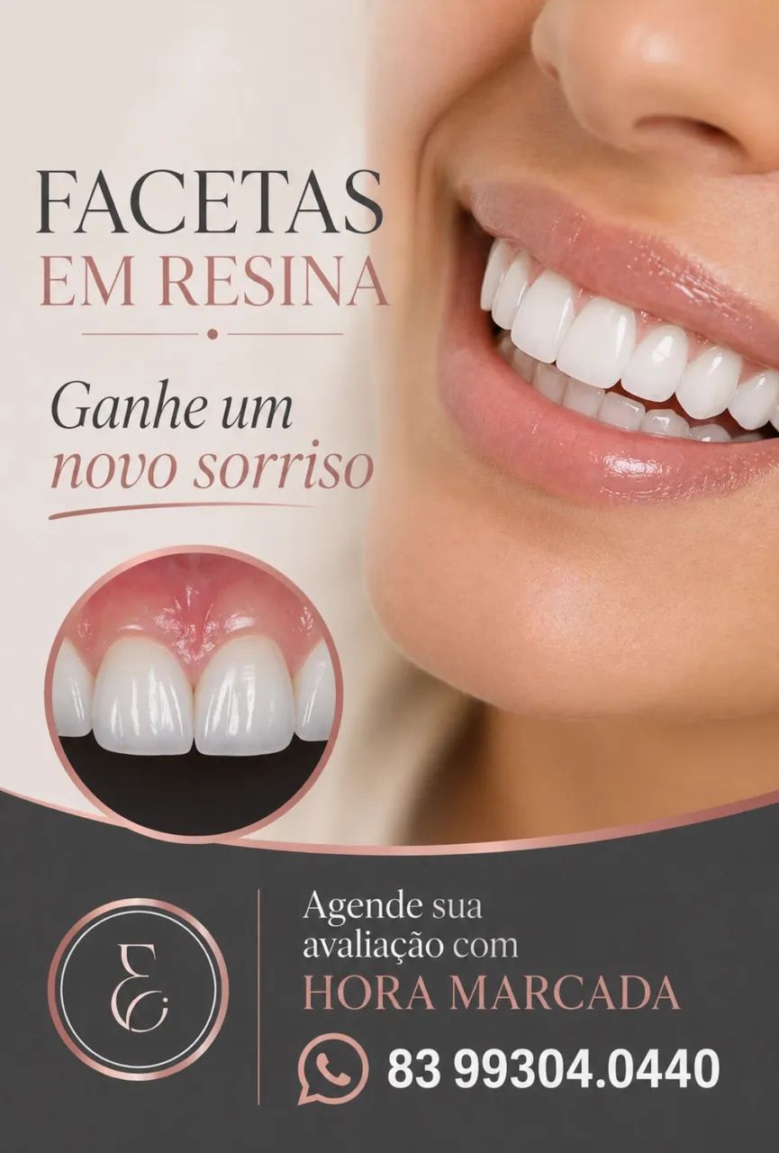 FACETAS EM RESINA - TRANSFORME SEU SORRISO COM NATURALIDADE E ALTO PADRÃO