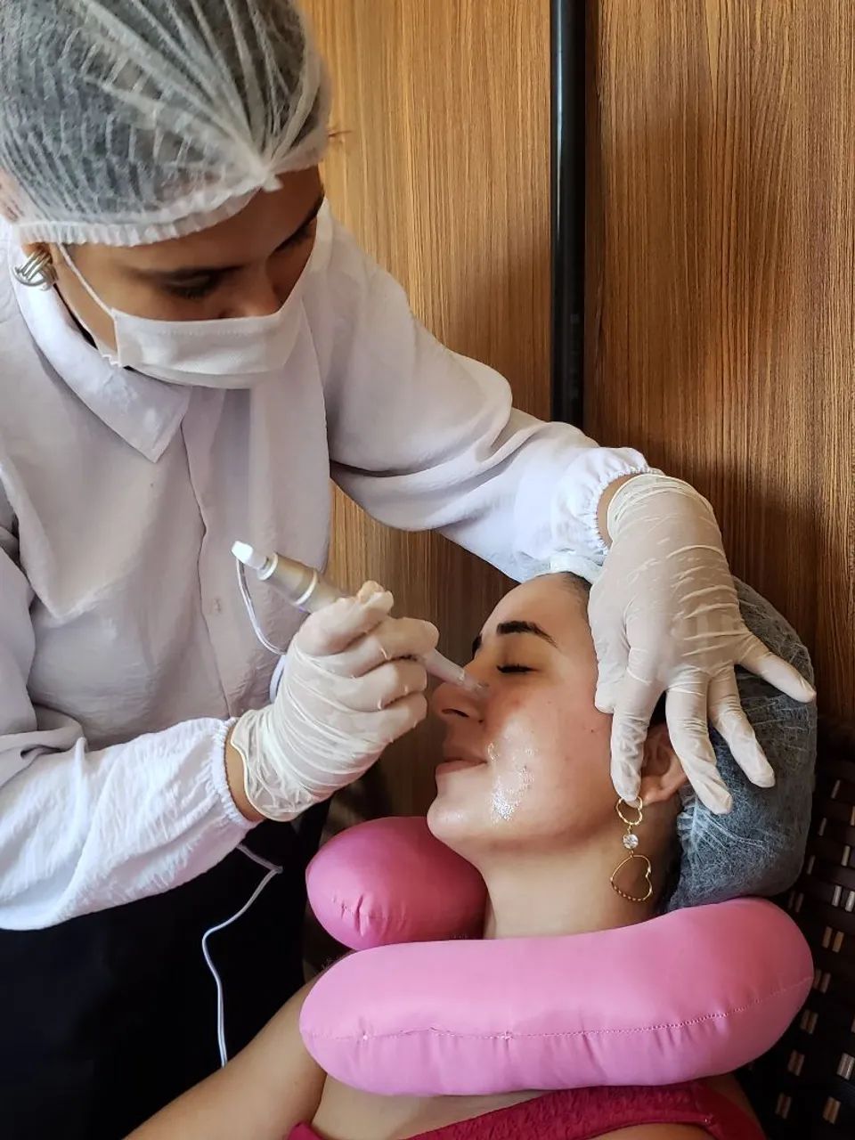 Microagulhamento facial - limpeza de pele básica  - Foto 3