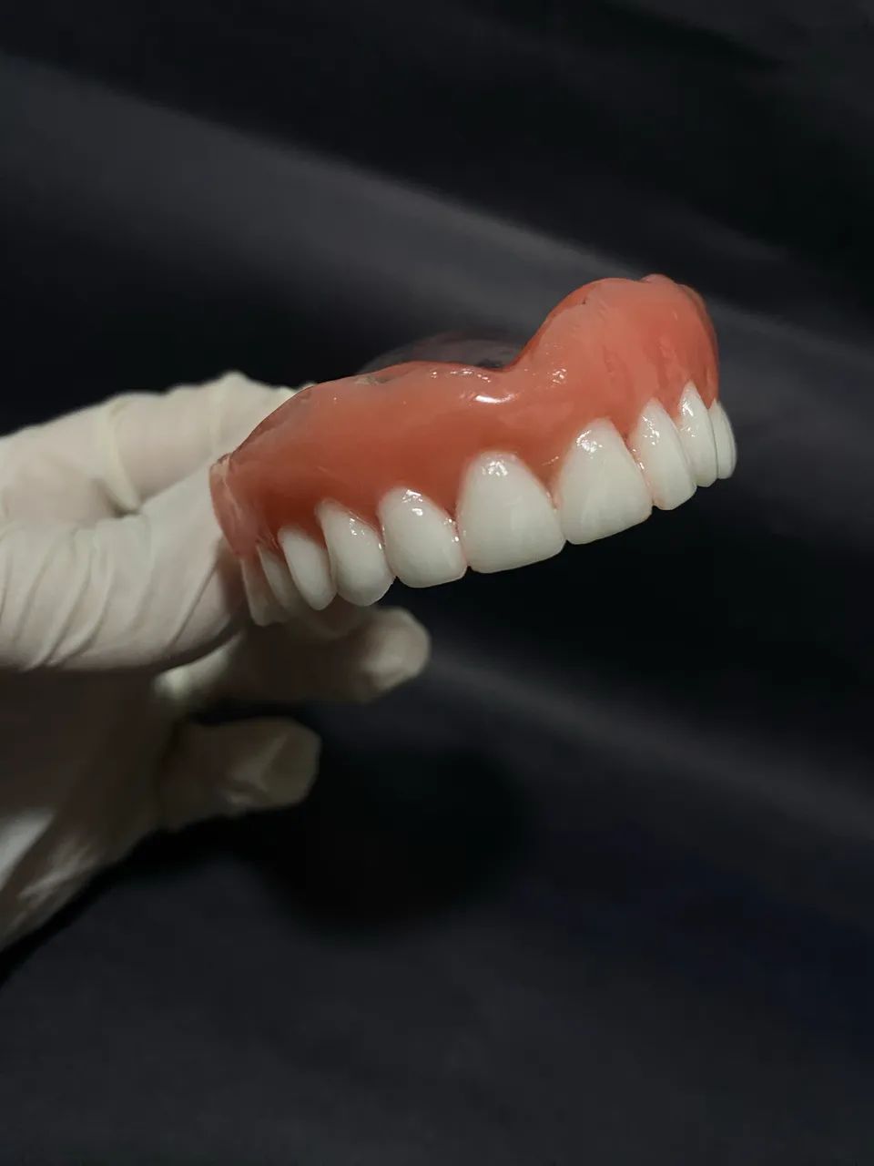 Dental Prosthesis