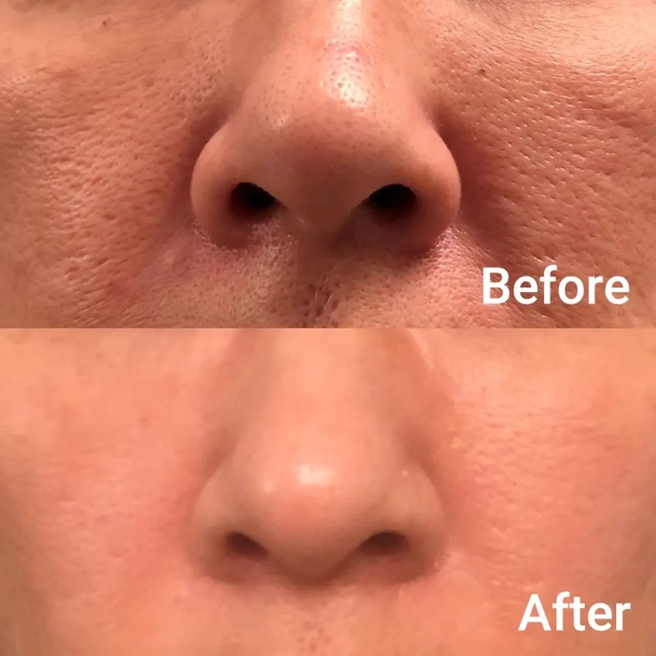 Medicube zero pore pad - Foto 3