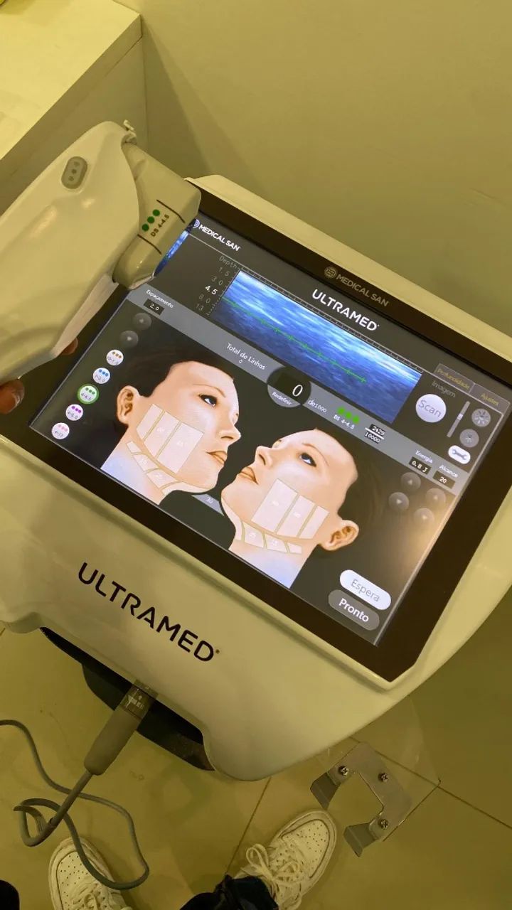 Ultrassom Microfocado e Macrofocado facial e corporal - Ultramed HIFU - Foto 2