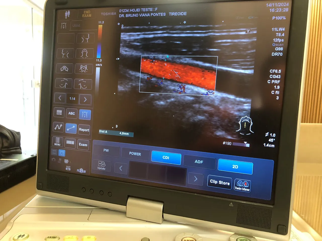 Ultrassom portatil