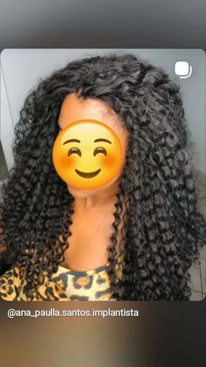 Implante Mega hair. - Foto 5