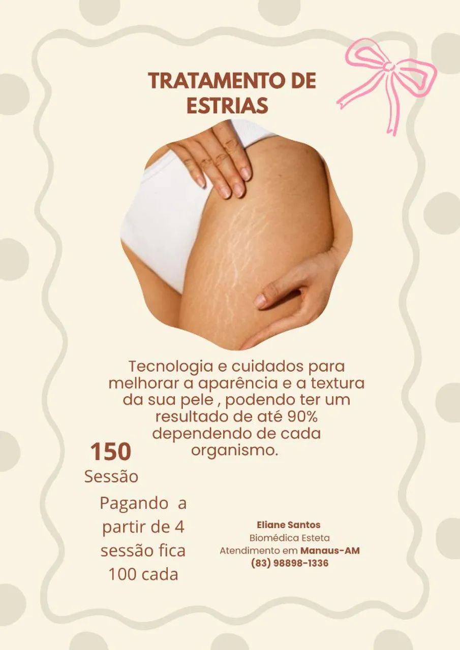 Tratamentos de estrias 