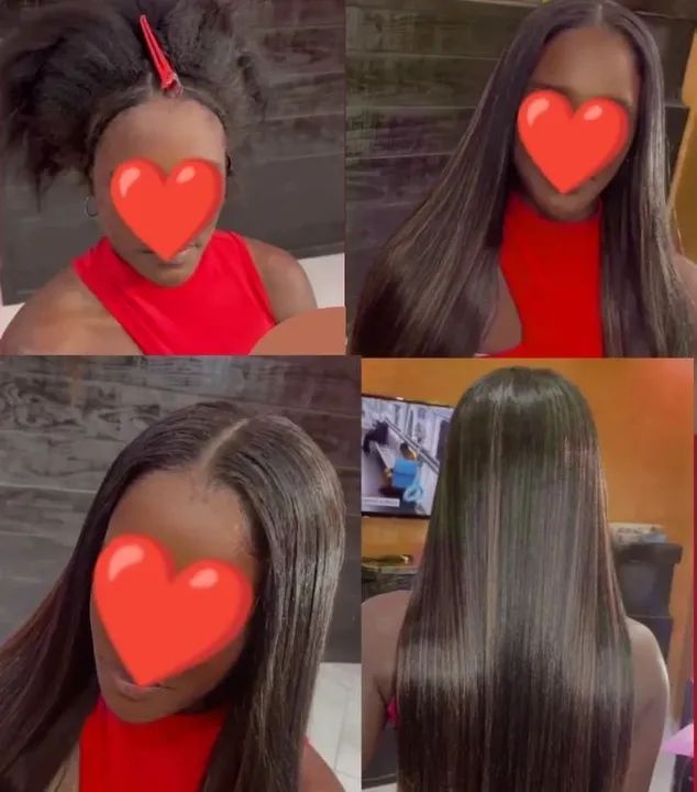 Implantista profissional a domicílio  - Foto 3