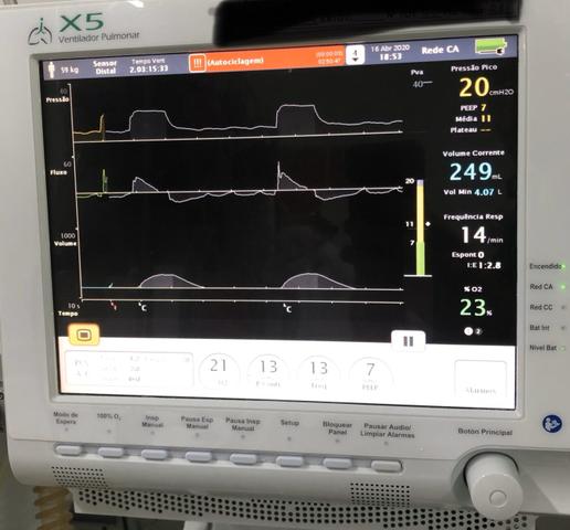 Ventilador pulmonar IX5 novo