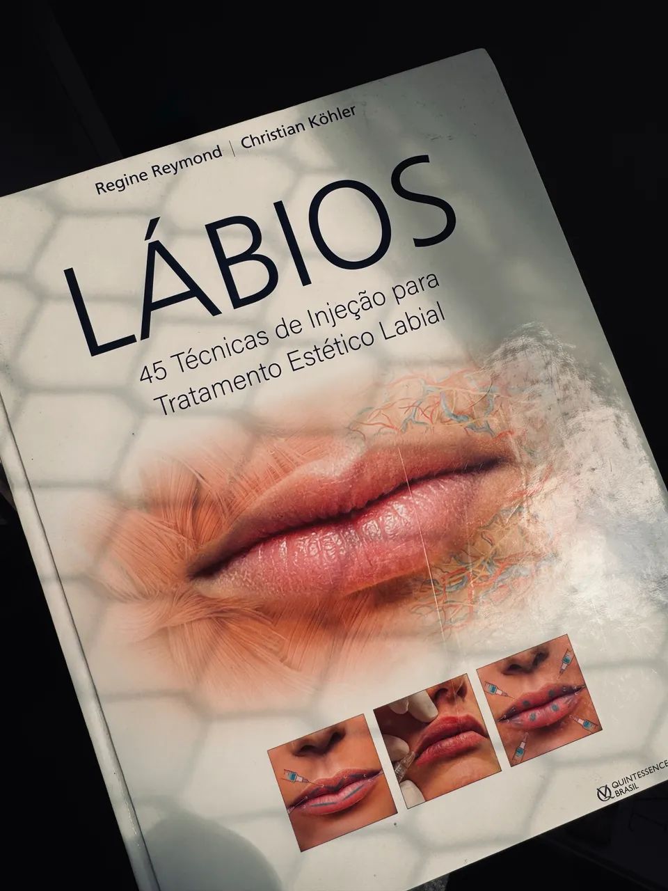 45 TÉCNICAS DE PREENCHIMENTO LABIAL - HOF