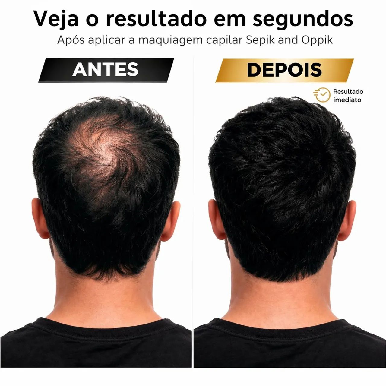 Fibra Capilar Várias Cores Maquiagem Capilar - Foto 5