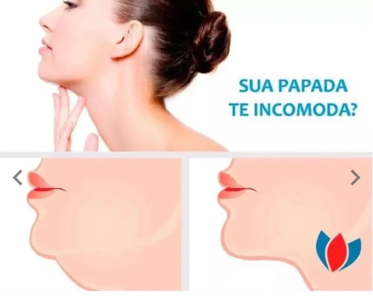 CINTA FACIAL nota fiscal nova  - Foto 2
