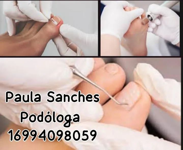 Paula Sanches Podóloga cuidando da saúde dos seus pés ? - Foto 2