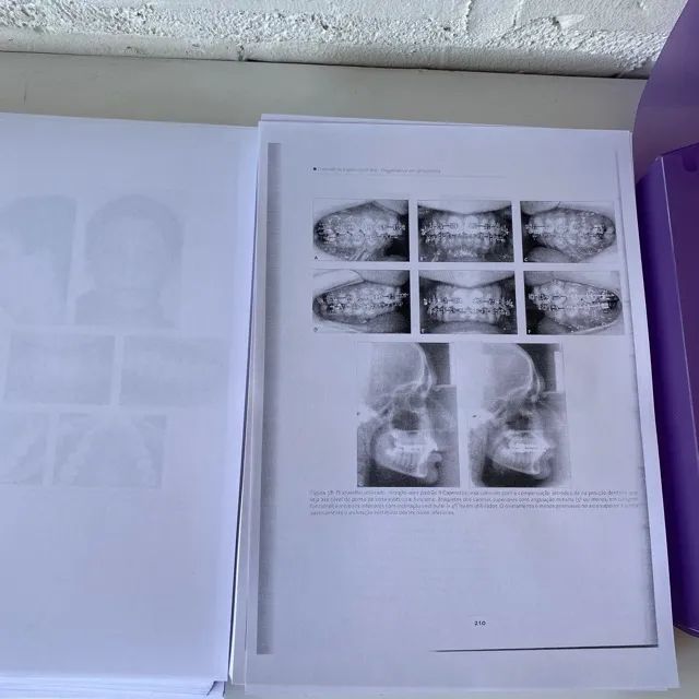 Ref.639 - Livro Diagnóstico em Ortodontia Leopoldo Capelozza Filho veja o anúncio - Foto 6