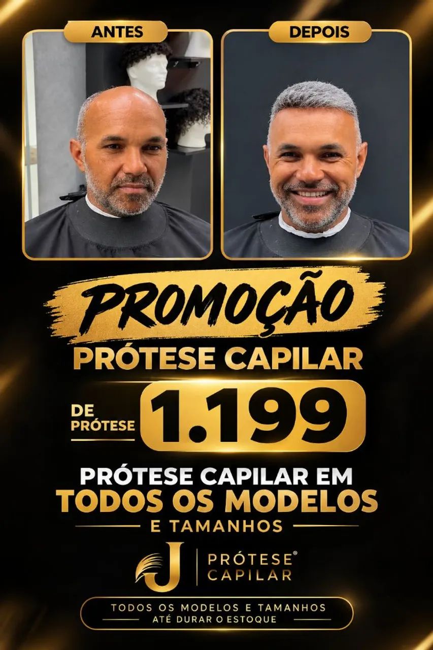 Prótese capilar instalada