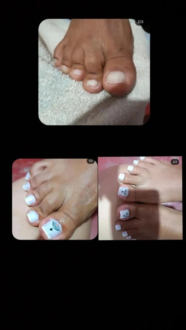 Unhas - Foto 2