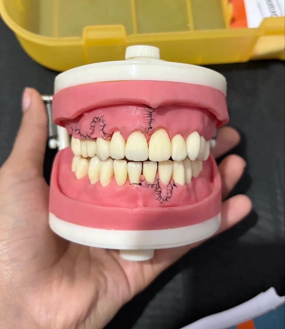 Manequim Periodontia - Pronew