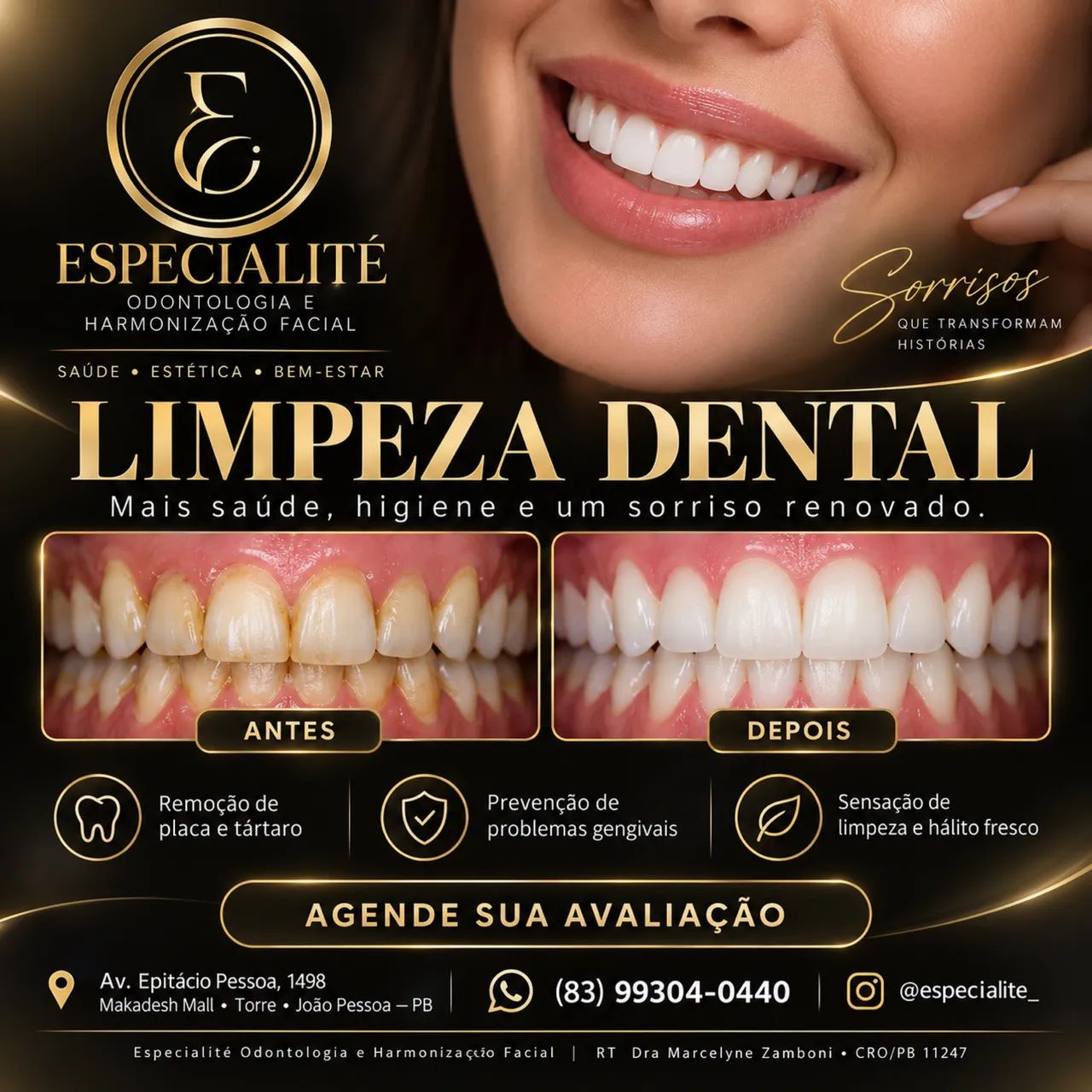 LIMPEZA DENTAL PREMIUM EM JOÃO PESSOA | ESPECIALITÉ
