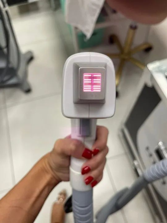 Ácrus - Aparelho Laser de Epilação Triple Wave - Foto 4