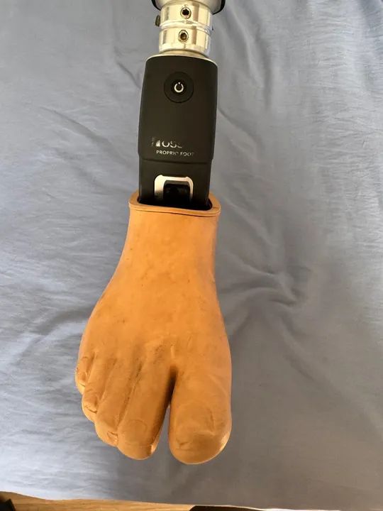 OSSUR PROPRIO FOOT ( pé biônico)  - Foto 3