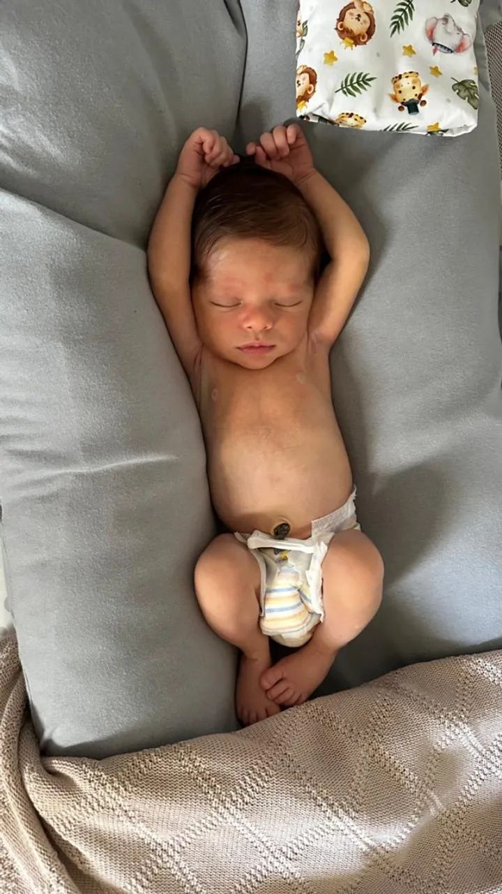 Ninho Yogi Baby com capa - Foto 3