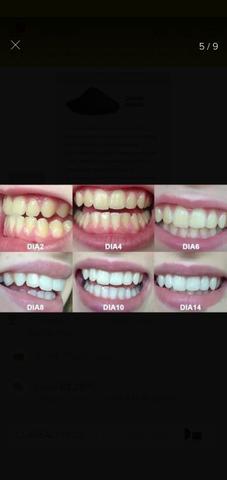 Clareador Dental 100% Natural - Foto 2