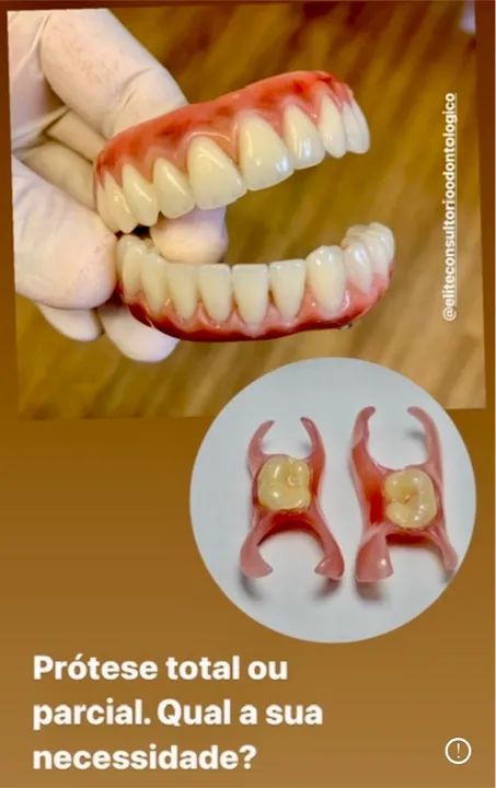 Protese dental (próteses, bride, dentaduras, pererecas, chapas, provisórios, implantes et