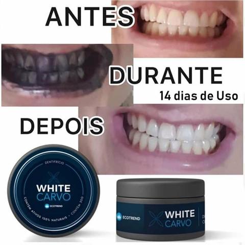 Clareador Dental 100% Natural