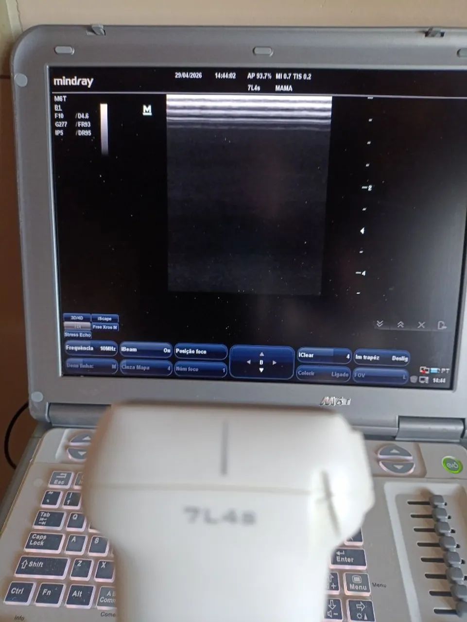 Ultrassom portátil M6 com cardio - Foto 2